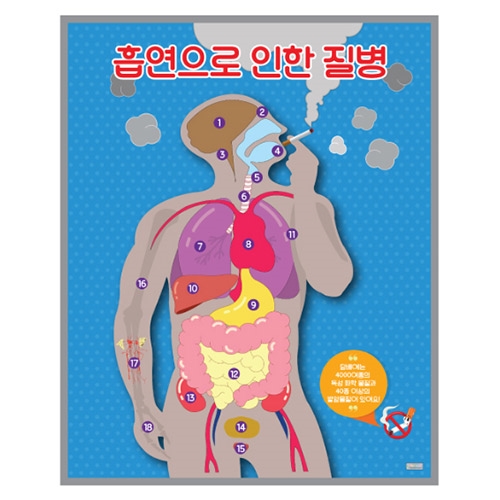 흡연과 질병 자석보드 세트
